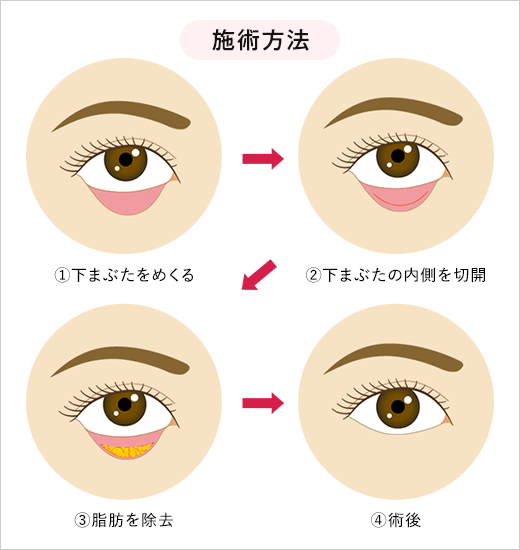 施術方法