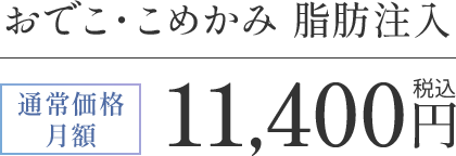 おでこ・こめかみ 脂肪注入