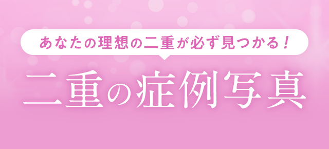 あなたの理想の二重が必ず見つかる！二重の症例写真