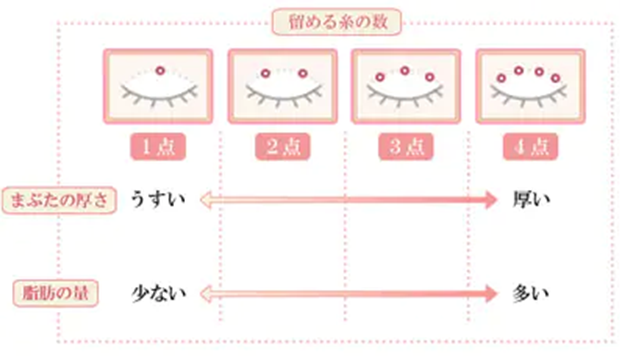 留める糸の数 まぶたの厚さ 脂肪の量