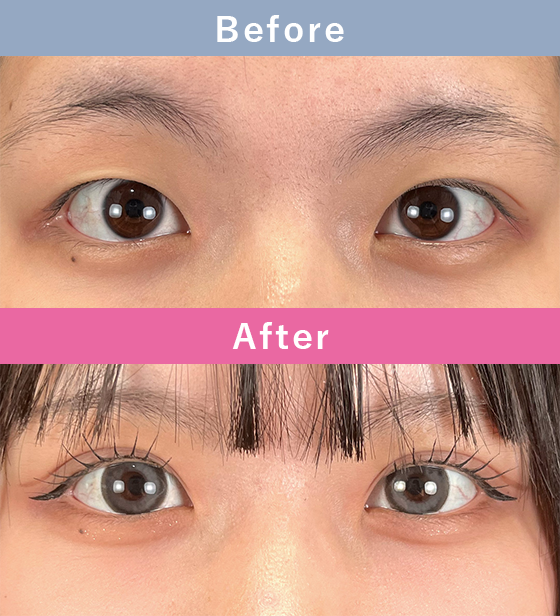 症例写真イメージ1