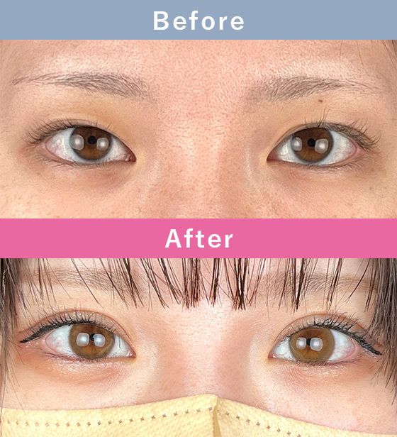 症例写真イメージ2