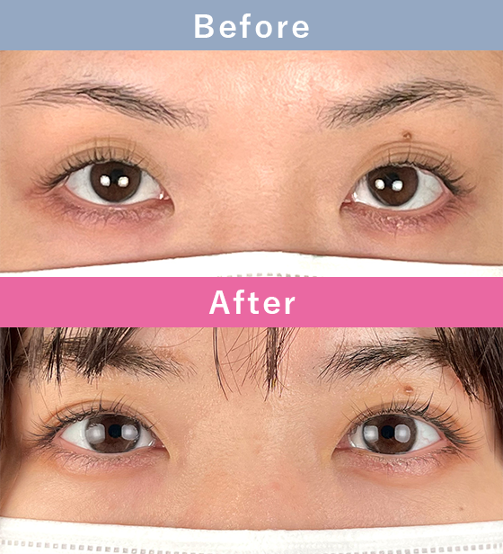 症例写真イメージ3