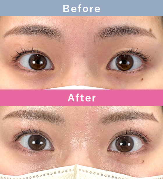 症例写真イメージ4