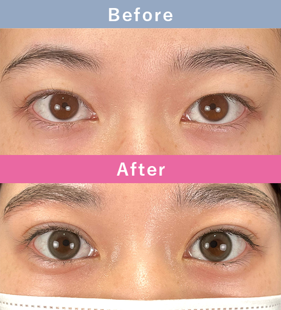 症例写真イメージ1