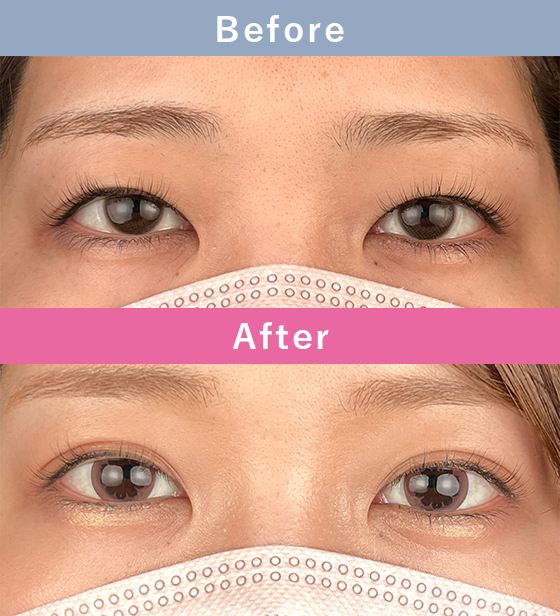 症例写真イメージ2