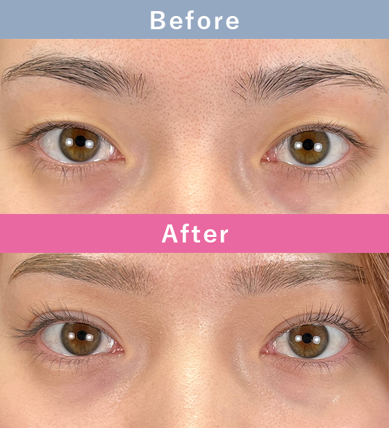 症例写真イメージ3