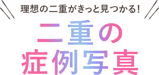 二重の症例写真