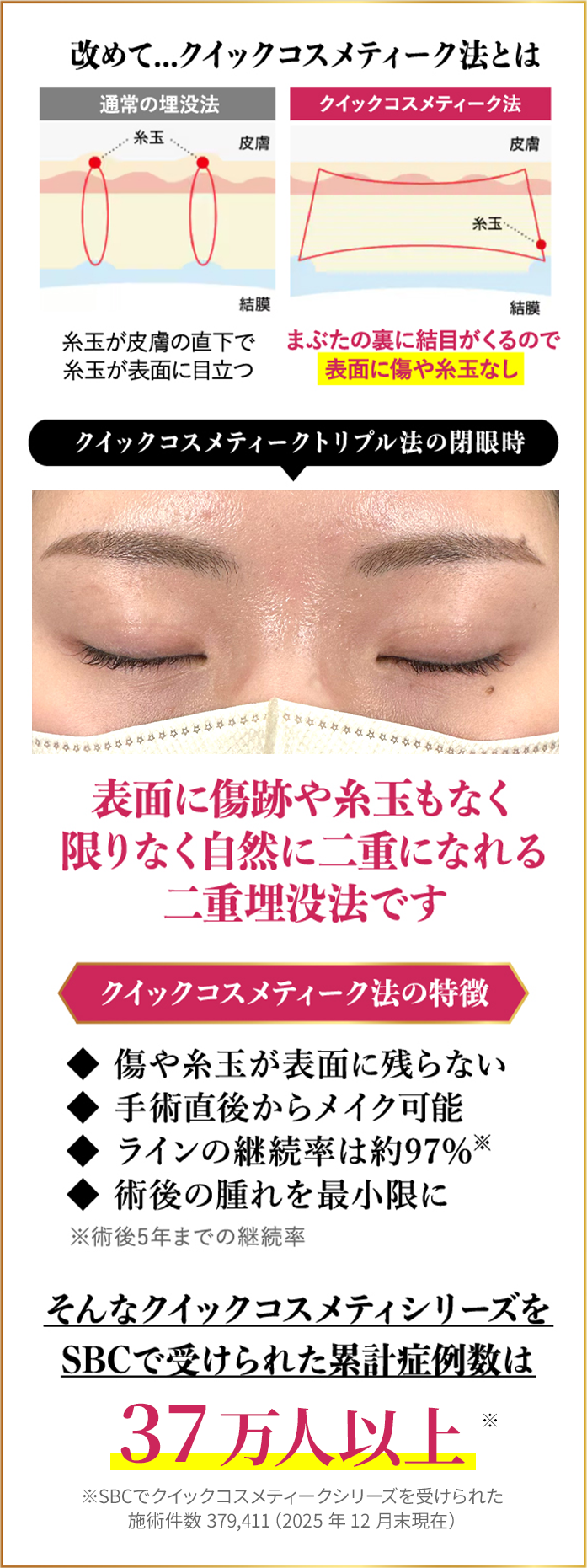 改めて...クイックコスメティーク法とは