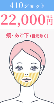 410ショット22,000円