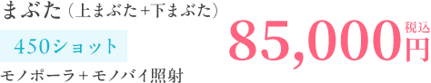 まぶた（上まぶた＋下まぶた）85,000円