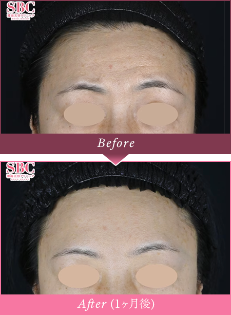Before Afterの写真
