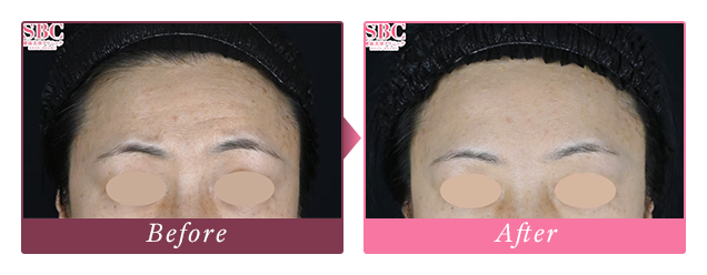 Before/Afterの写真
