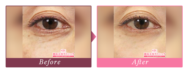 Before/Afterの写真