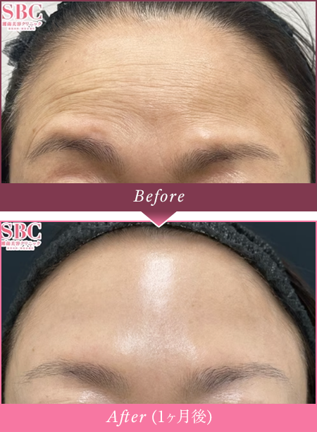 Before Afterの写真
