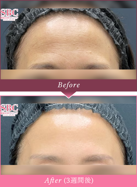 Before Afterの写真