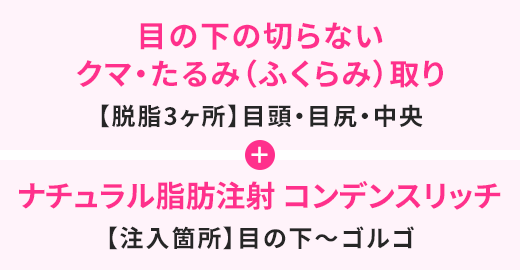 ナチュラル脂肪注射 コンデンスリッチ