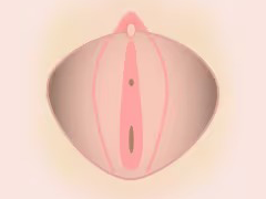 小陰唇の黒ずみ