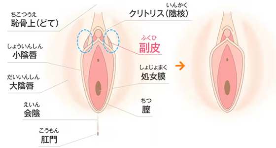 副皮除去の説明図