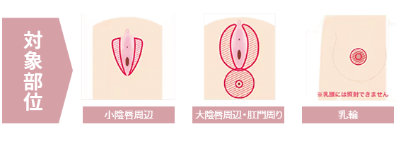 ジュリエットレーザーの対象部位説明図