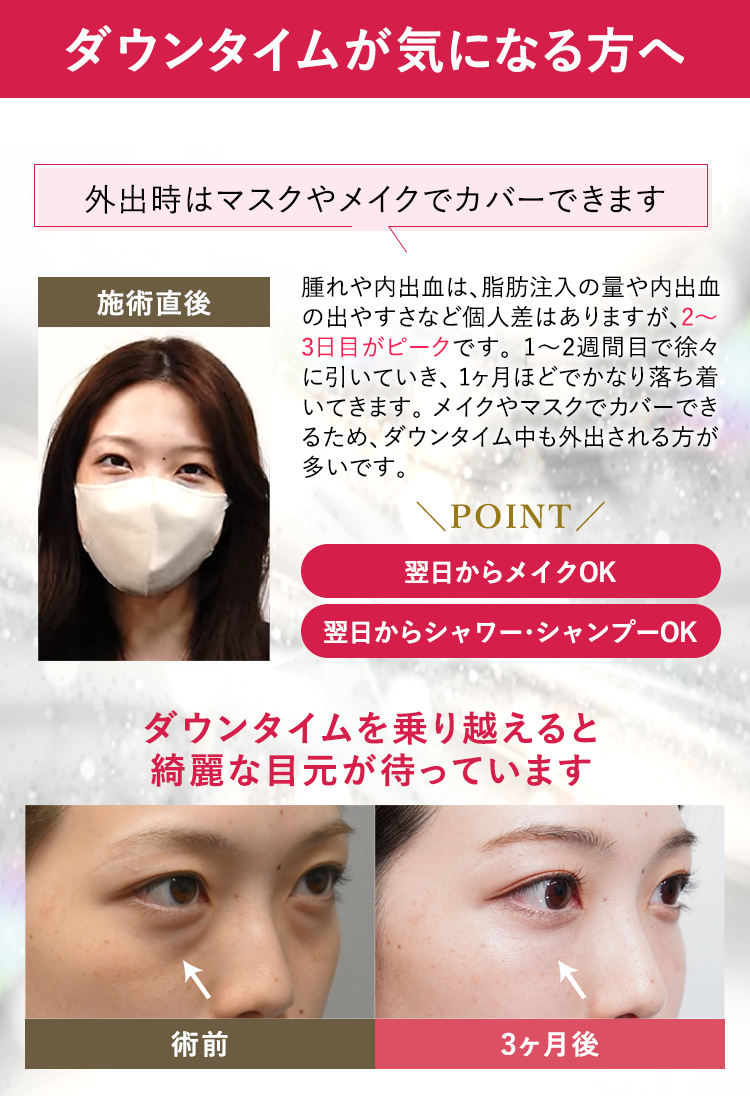 本田先生の技術でダウンタイムも最小限に！