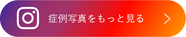 症例写真をもっと見る