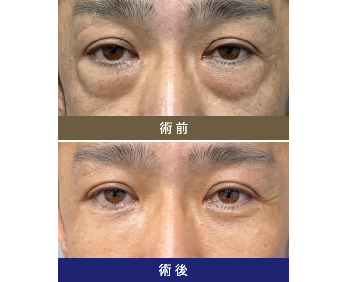 術前術後