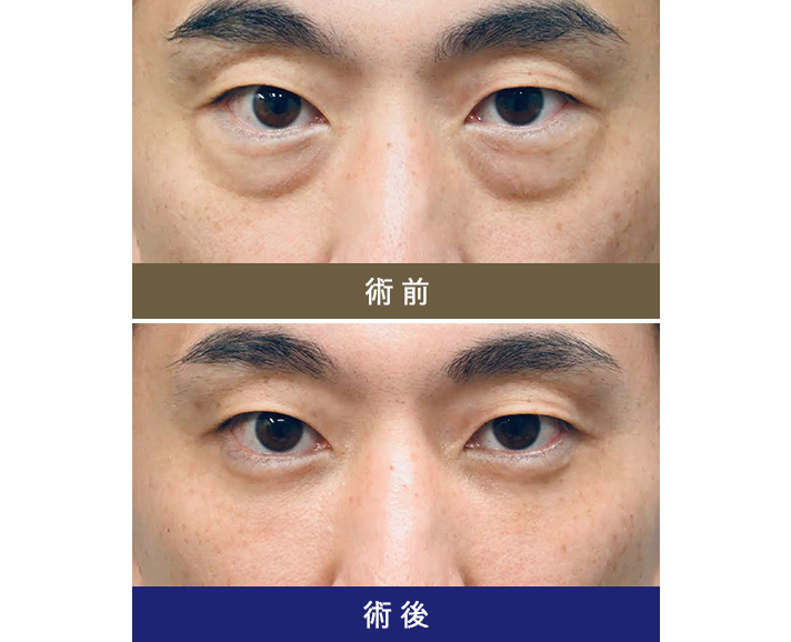 術前術後