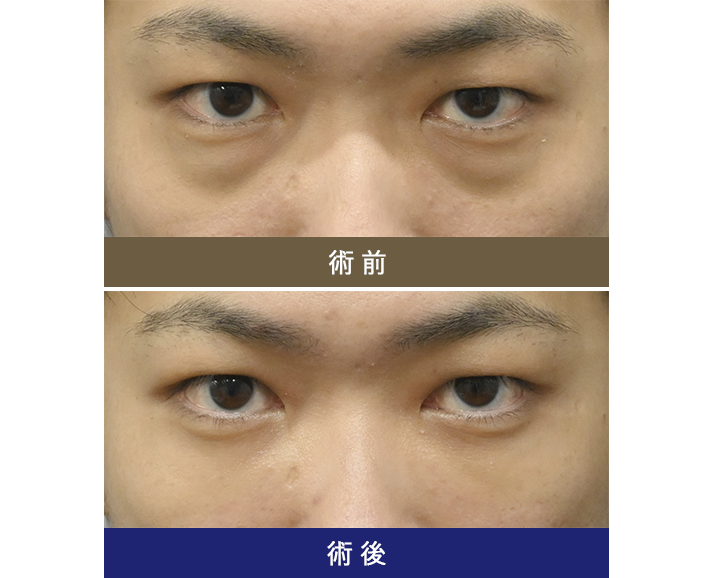 術前術後