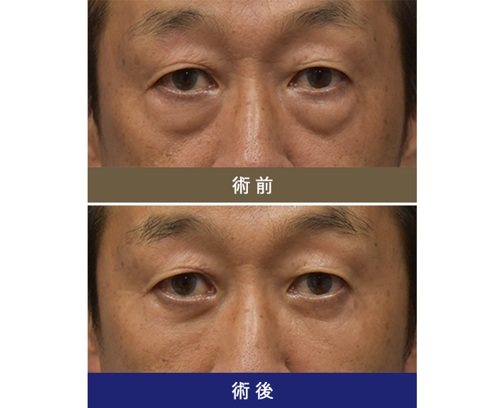 術前術後