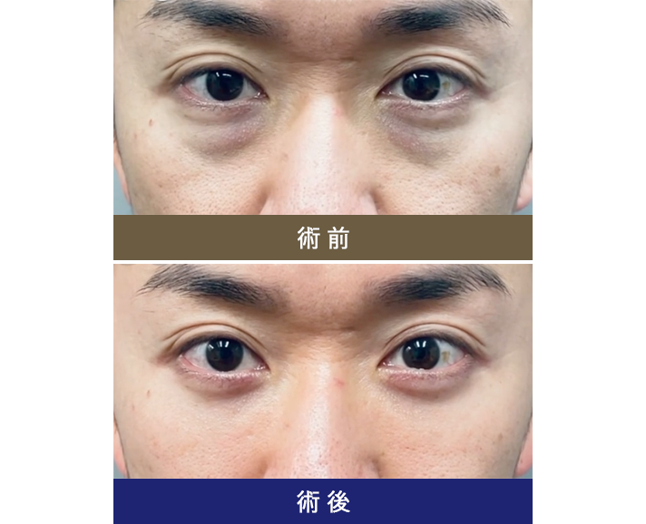 術前術後