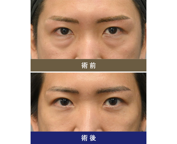 術前術後