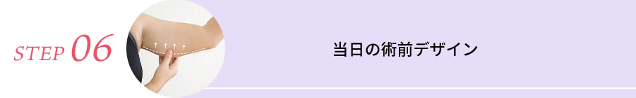 STEP06 当日の術前デザイン