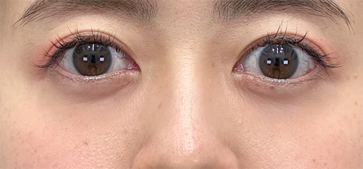 施術後のイメージ