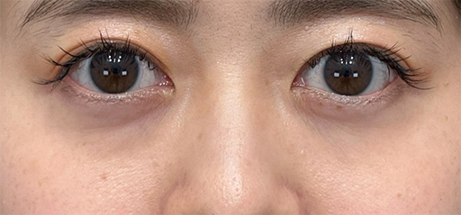 施術前のイメージ