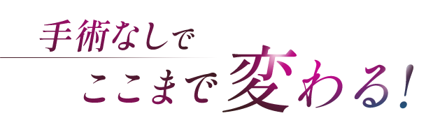 手術なしでここまで変わる！