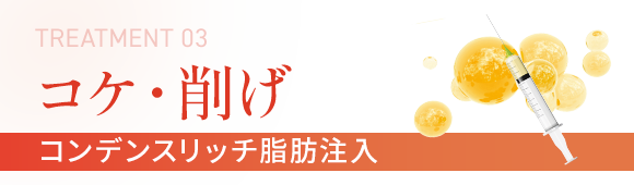コケ・削げ コンデンスリッチ脂肪注入