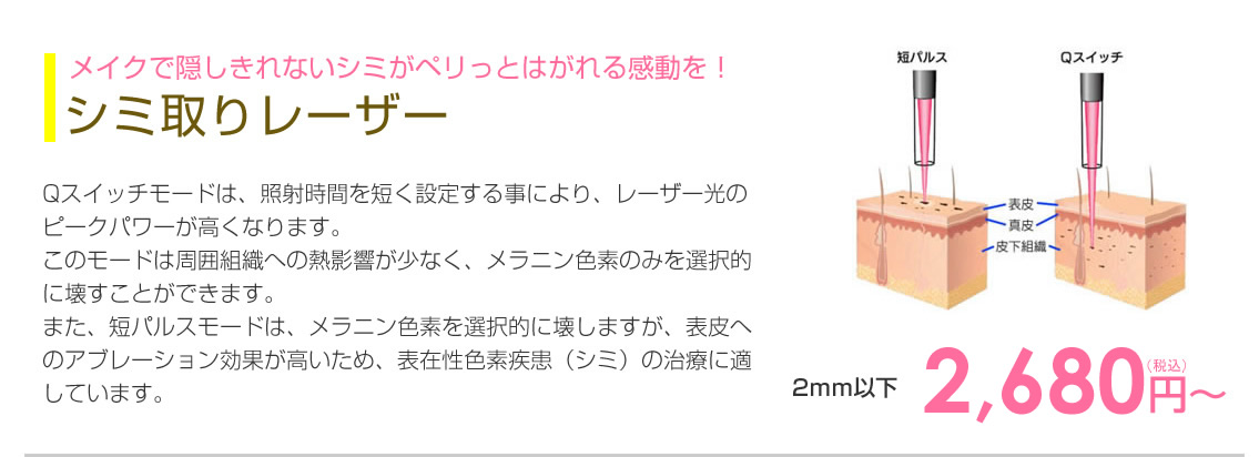 しみ取りレーザー