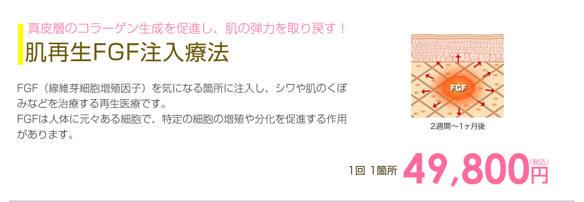 肌再生FGF注入療法