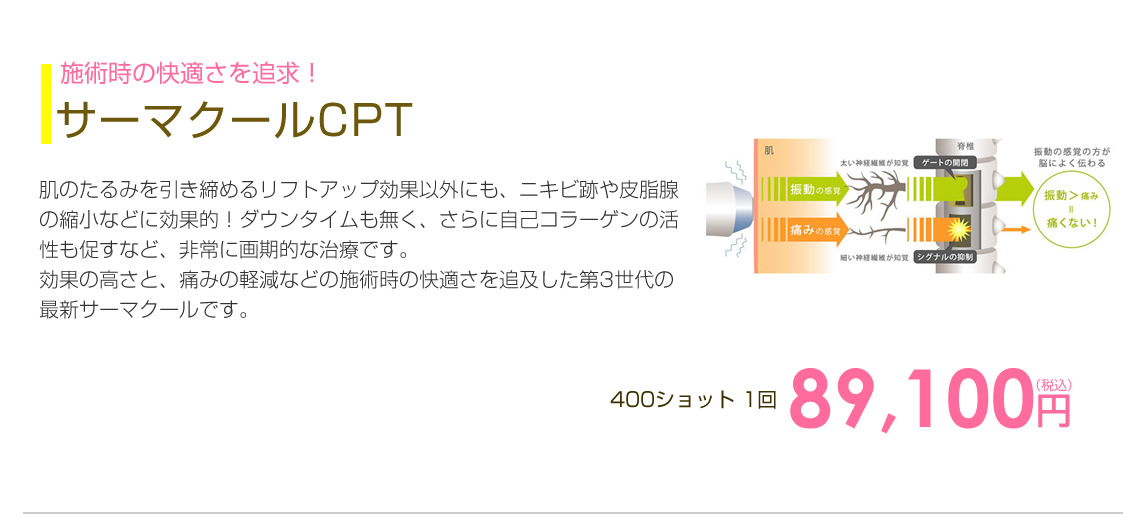 シークレットリフト