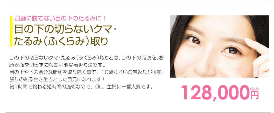小顔リフト