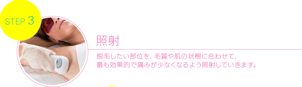 照射 脱毛したい部位を、毛質や肌の状態に合わせて、最も効果的で痛みが少なくなるよう 照射していきます 