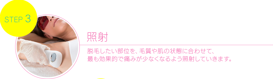 本照射 脱毛したい部位を、毛質や肌の状態に合わせて、最も効果的で痛みが少なくなるよう 照射していきます 