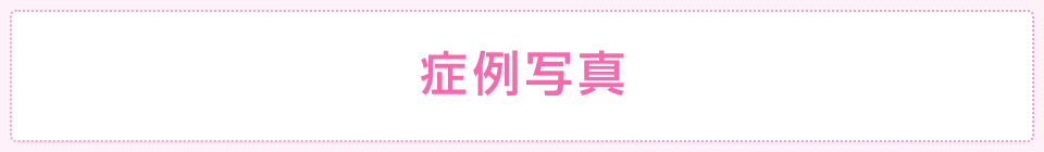 症例写真