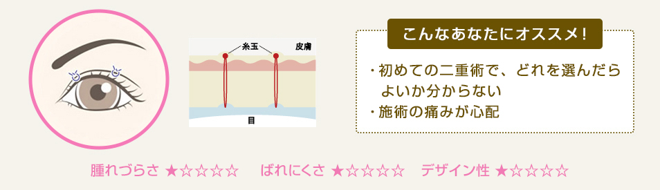 こんなあなたにオススメ！ ・初めての二重術で、どれを選んだらよいか分からない・施術の痛みが心配・リーズナブルな価格で試したい