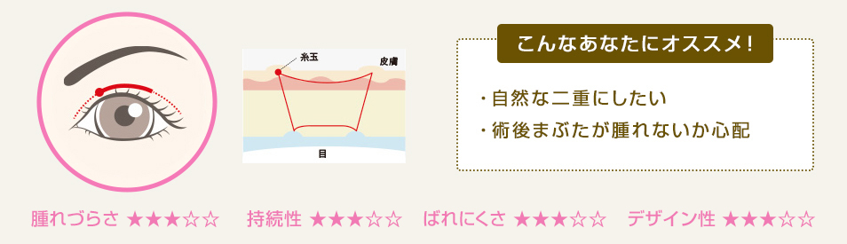 こんなあなたにオススメ！ ・自然な二重にしたい ・メイク感覚で施術したい ・持ちが良い方が良い