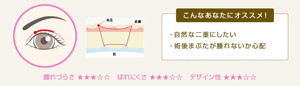 こんなあなたにオススメ！ ・自然な二重にしたい ・メイク感覚で施術したい ・持ちが良い方が良い