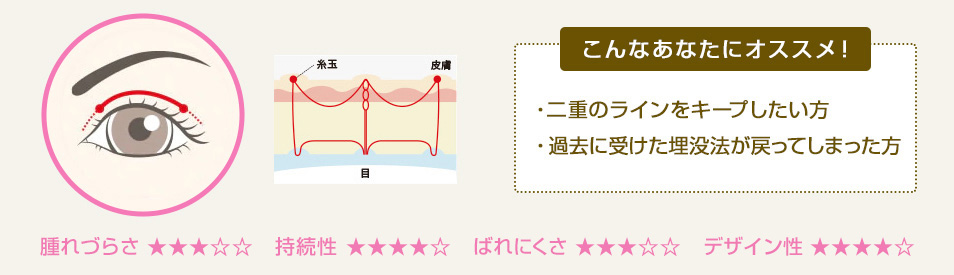 こんなあなたにオススメ！ ・広いラインをお求めの方 ・過去に埋没法を受けたけど戻ってしまった方 ・皮膚たるみの強い方