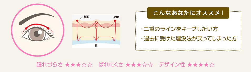 こんなあなたにオススメ！ ・広いラインをお求めの方 ・過去に埋没法を受けたけど戻ってしまった方 ・皮膚たるみの強い方