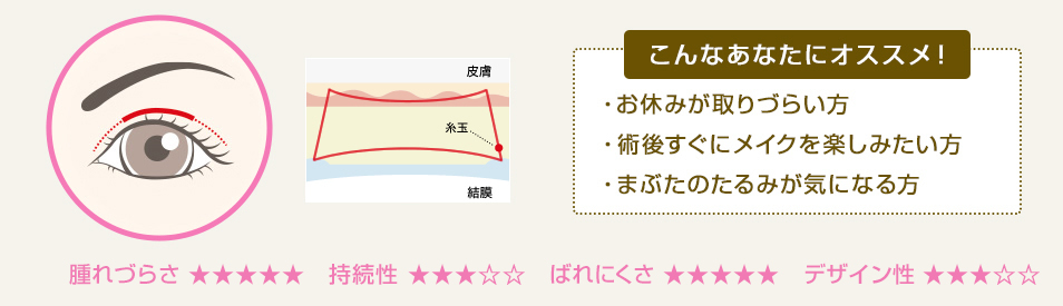 こんなあなたにオススメ！ ・キリッと目力のある二重になりたい ・アイプチを手放せない方 ・まぶたのたるみが気になる方